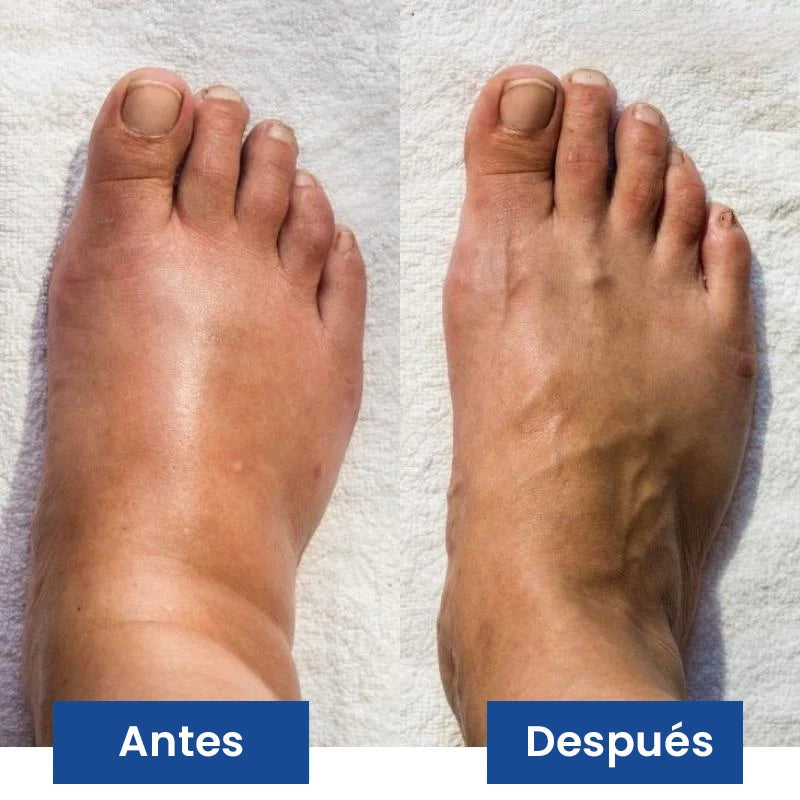 Masajeador de Recuperación